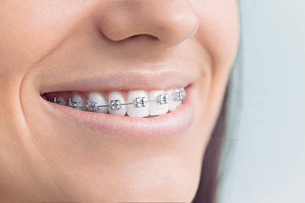 Best Wisdom Tooth Removal  in East Wenatchee, WA